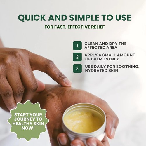 KESMEDIK Tea Tree Oil Balm - Soothes Itching & Rashes | Antifungal Relief for Skin Issues