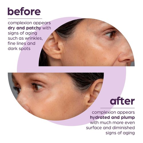 50% Beta Glucan Anti-Aging, Plumping Serum