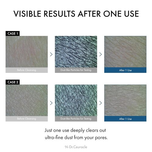 Dr.Ceuracle Pro Balance Enzyme Powder Face Wash - Korean Natural Cleanser for Deep Pore Cleansing & pH Balance (Night Wash)