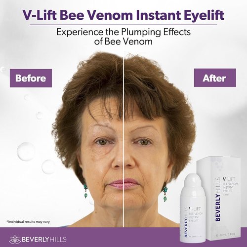 Beverly Hills V-Lift Bee Venom Eye Serum - Instant Lift for Dark Circles & Puffiness | 30mL (120 Day Supply)