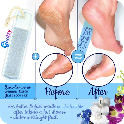 GLADZY Glass Nail File Set – Czech Crystal Nail Files for Natural Nails, Glass Foot File Callus Remover, Professional Manicure & Pedicure Kit for Fingernails & Toenails with Case and Towel, Made in EU