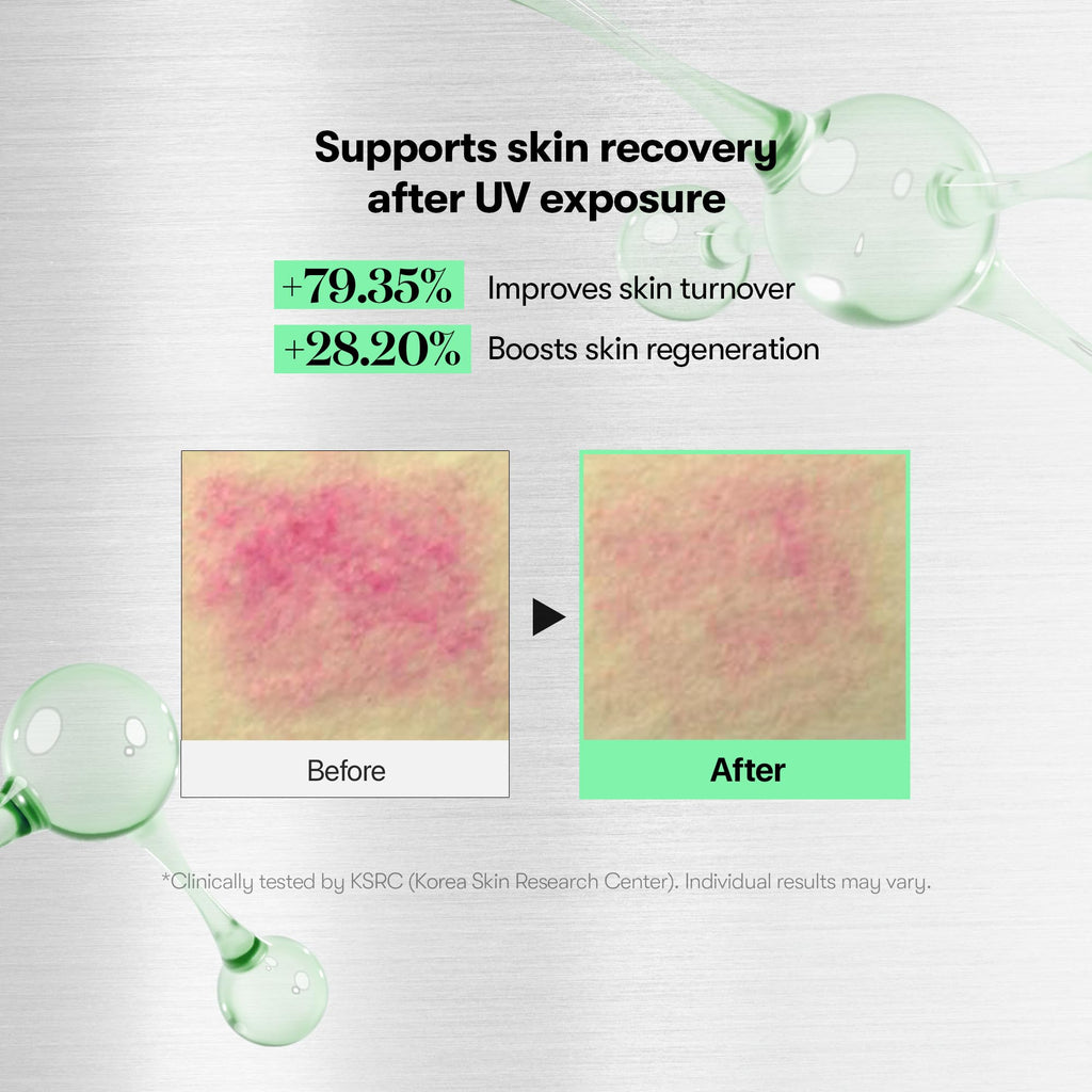 VT COSMETICS CICA Reedle Shot 700, Spicule Microneedling Serum for Pore Care&Exfoliation, Exosome&Centella Asiatica for Glass Skin, Acne&Blemish Care, Korean Liquid Skin Booster (1 Fl Oz / 30ml)