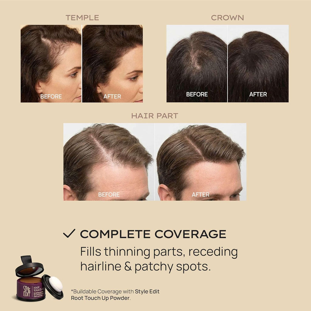 Style Edit Hair Building Fibers - Conceal Thinning Hair & Receding Hairlines | 100% Plant-Based, Dark Brown 0.88oz