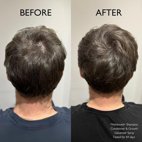 Daimon Barber Hair Growth Galvanizer for Men - Advanced Plus Formula | 3.38 oz Spray
