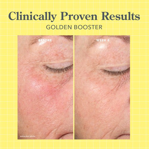 Beekman 1802 Golden Booster Amla Berry Face Serum – Plant-Based Vitamin C Alternative – Brightening & Tone-Evening Serum – Helps Reduce the Look of Dark Spots – Sensitive Skin Safe – 1 fl oz