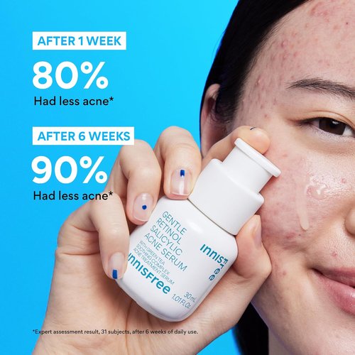 Innisfree Gentle Retinol Salicylic Acne Serum - Korean Face Treatment for Clear Skin & Blemish Control