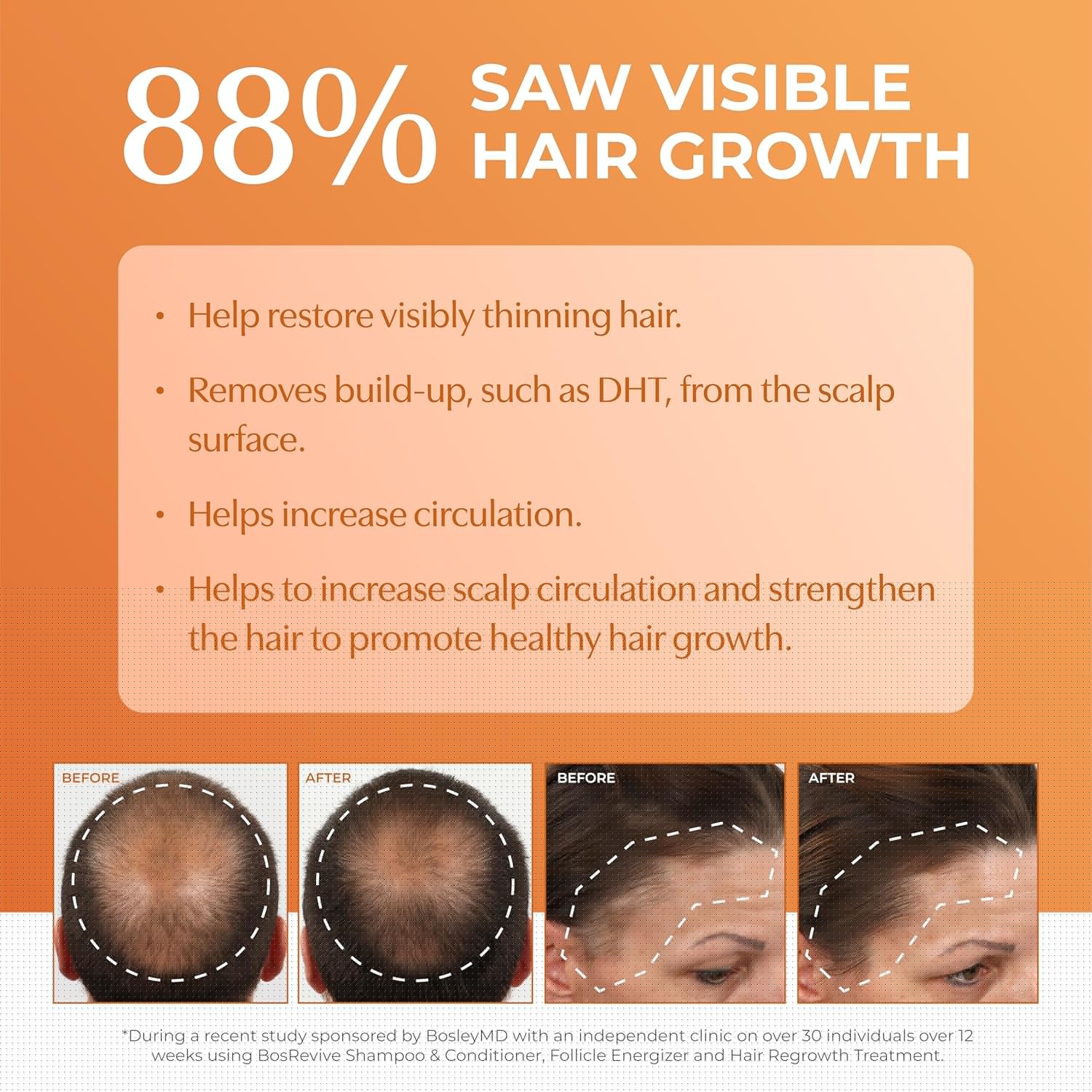 BosleyMD BosRevive Hair Care Kit - Color-Safe Solution for Thinning Hair | 30-Day Starter Size with Biotin & Botanical Extracts