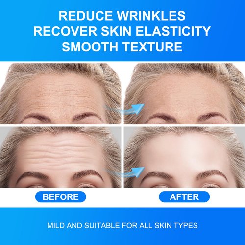 Auteek Forehead Wrinkle Patches Overnight 20pcs with Collagen & Seaweed Polysaccharides, Anti Wrinkle Patches for Smooth Fine Lines & Wrinkles, jelly forehead patches Treatment for Skin Care