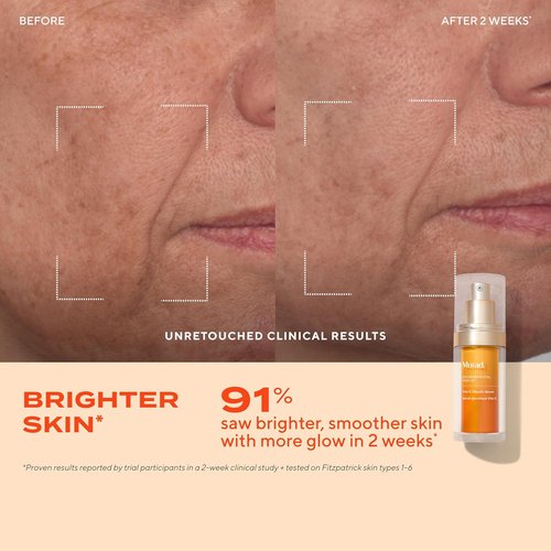 Murad Brighten Trial Kit - Vitamin C Skincare Set for Radiant, Even-Toned Skin | Travel-Friendly