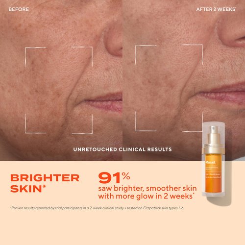 Murad Brighten Trial Kit – Vitamin C Skincare Set for Brighten & Even Tone - Travel-Friendly Kit for Radiant, Even-Toned Skin (3-Piece Glow Better Kit)