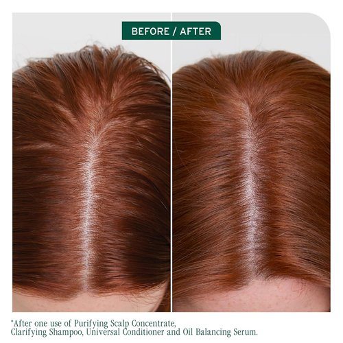 Biolage Scalp Sync Clarifying Shampoo & Conditioner Set - Removes Residue & Excess Oil, Vegan, 33.8 Fl Oz