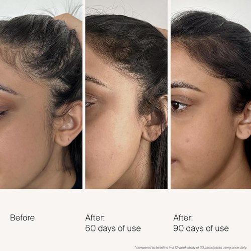 Living Proof Scalp Care Density Serum - Boost Hair Thickness & Nourish Scalp | 1.7 oz