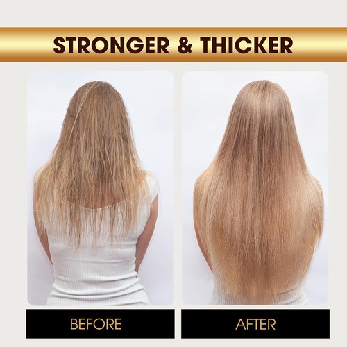 Herb Hair Growth Oil Spray - Strengthen Thinning Hair & Boost Scalp Health for Women & Men