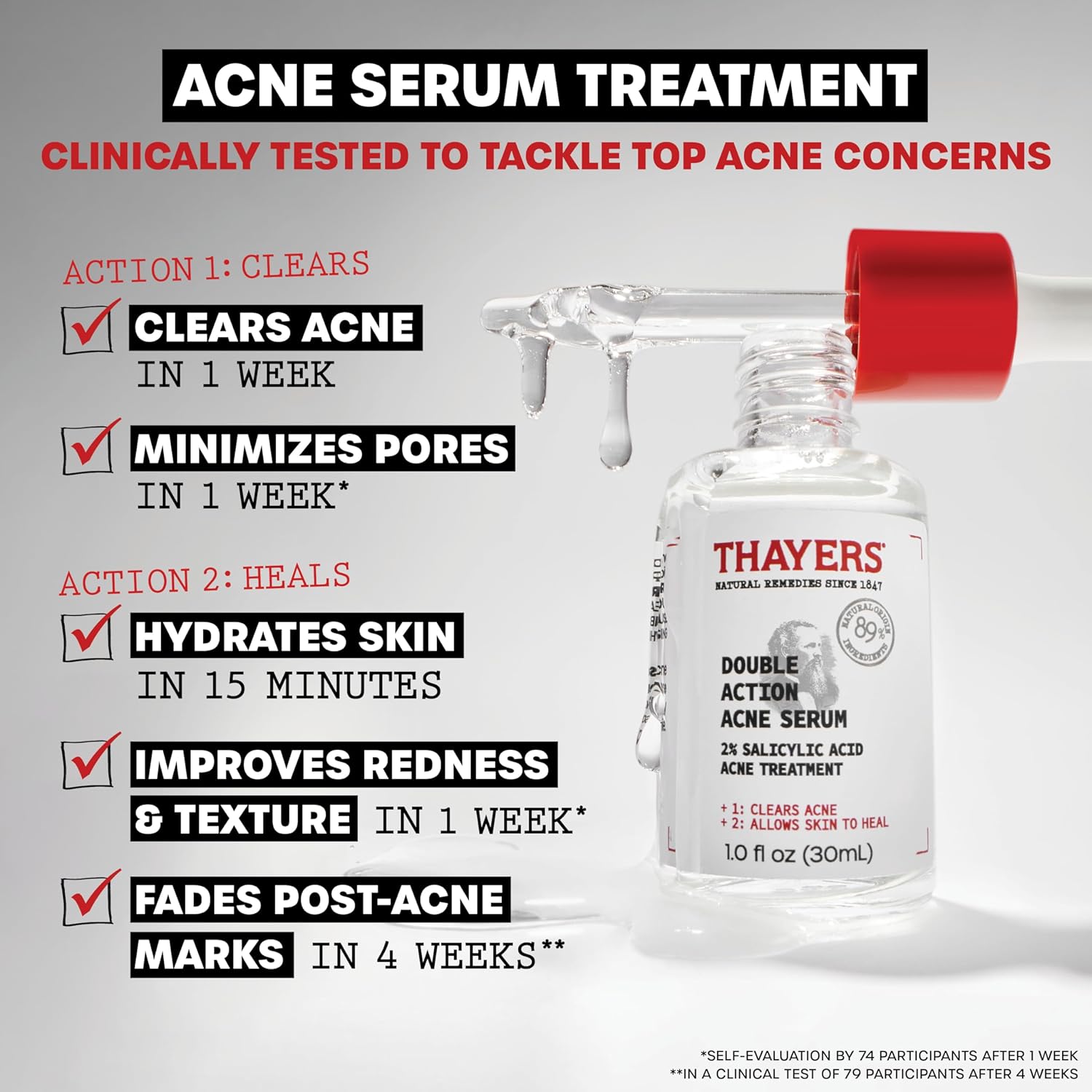 Thayers Acne Serum - Double Action Treatment with 2% Salicylic Acid & Niacinamide | 1 Fl Oz