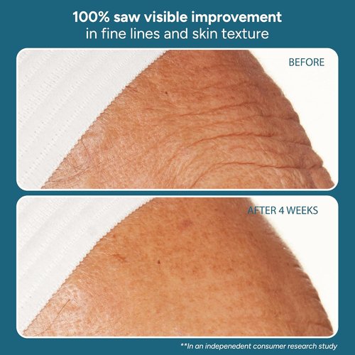 Lancer Skincare The Method - Nourishing Anti-Aging Moisturizer with Hyaluronic Acid | For Normal & Combination Skin