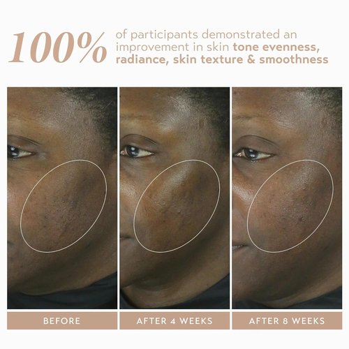 SHANI DARDEN SKIN CARE Retinol Reform Serum - 1% Encapsulated Retinol for Youthful Skin, 1 fl oz