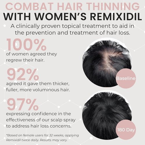 Regine Switzerland 2% Minoxidil Hair Regrowth Spray - Clinically Proven Solution for Thicker, Fuller Hair - 60 ml