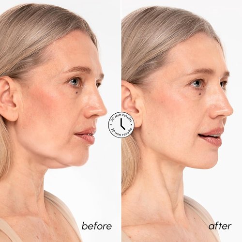 MAREE V Line Lifting Mask - 24K Gold Deep Collagen Face Mask for Women - Neck Tightening & Firming