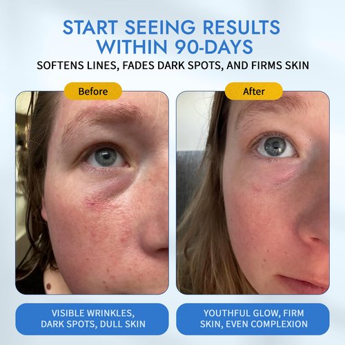 MAELOVE Moonlight Advanced Retinal Super Serum, 10x Stronger than Regular Retinol, for Softening Lines and Wrinkles, Reducing Dark Spots, Improving Skin Firmness, Vegan, Cruelty-Free, 1.0 fl oz
