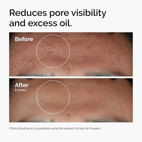 The Ordinary Serum Favorites Set - Hydrating Hyaluronic Acid 2% + B5, Brightening Niacinamide 10% + Zinc 1%, Caffeine Solution 5% | Eye & Face Care
