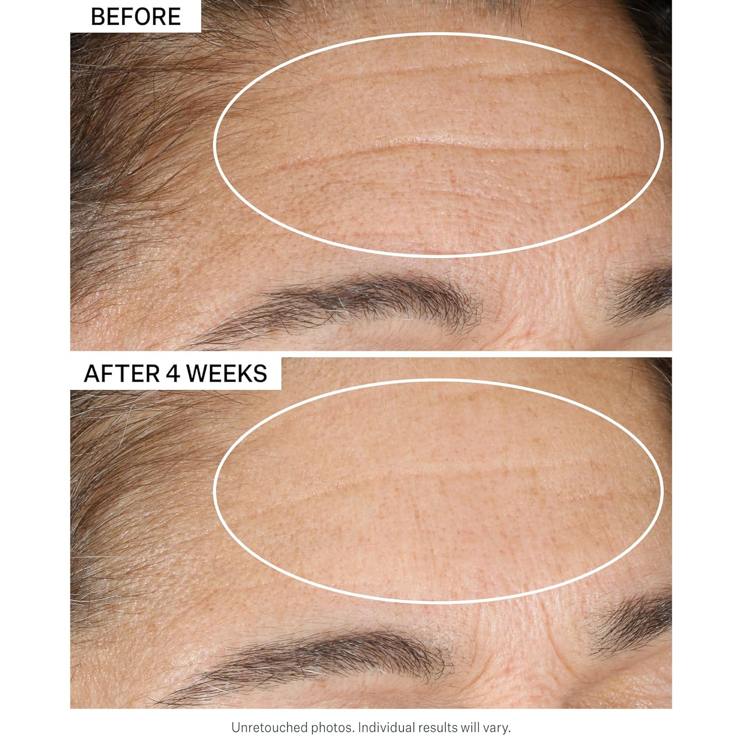 StriVectin Advanced Retinol Discovery Kit - Night Moisturizer & Eye Cream for Wrinkles | 2-Piece Set