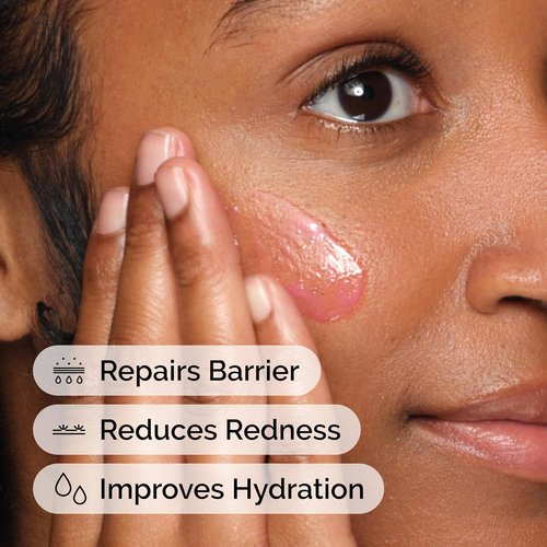 The Ordinary Soothing Serum - Redness-Reducing & Hydrating Skin Barrier Support | 30ml