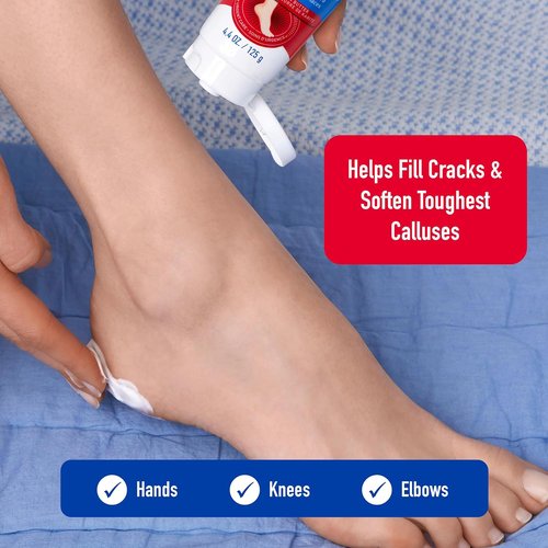 Heal&Rescue Heel Rescue Cream - Concentrated AHA & Shea Butter for Cracked Heels | 4.4 Ounce