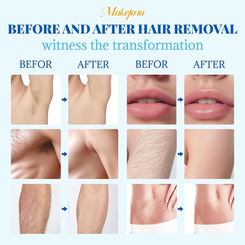 Hair Removal Wax Beads 2.2lb (1000g), Waxing for Whole Body, Painless Hair Removal Waxing for Women and Men, 10 Flavours, Contains 20 Wax Sticks