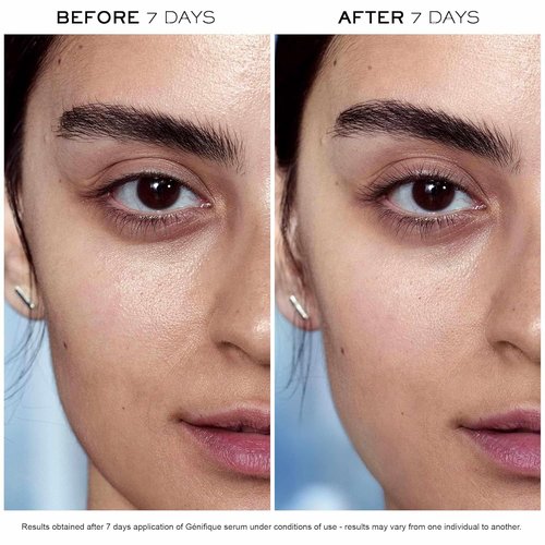 Lancôme Advanced Genifique Anti-Aging Serum & Eye Cream Duo - Hydrates & Plumps Skin - With Bifidus Prebiotic, Hyaluronic Acid & Vitamin Cg