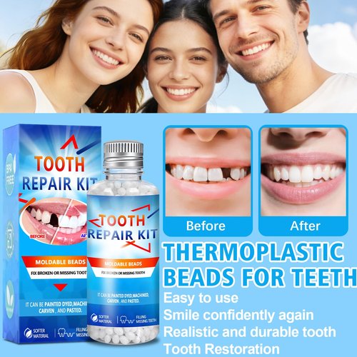 Moldable False Teeth Beads, DIY Temporary Tooth Replacement Kit, Suitable for Missing, Broken and Chipped Tooth Repair Beads, Thermoplastic Beads, Make You Smile Confidently