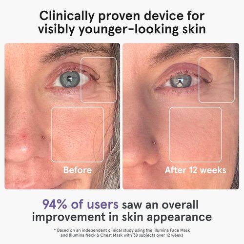 iRestore LED Face Mask - Youthful Skin Red Light Therapy | 360 LEDs for Wrinkles & Dark Spots