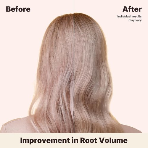 Skiennix Deep Volumizing Conditioner for Thinning Hair - Biotin & Panthenol for Damage Repair | 16.9 fl oz