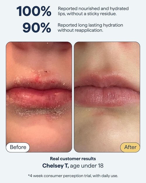 Dr. Shah Lip Balm Ointment - All-In-One Hydrating Treatment with Ceramides & Peptides | Repairs Dry, Cracked Lips