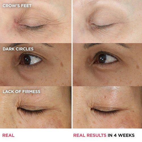 IT Cosmetics Confidence in an Eye Cream - Anti-Aging Peptide Formula for Dark Circles & Wrinkles, 48HR Hydration, 2% Super Peptide, Smooths & Brightens Undereye