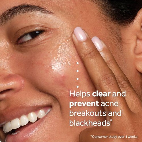 No7 Derm Solutions Salicylic Acid Facial Cleanser - Exfoliating Face Wash for Acne-Prone Skin | 6.7 fl oz