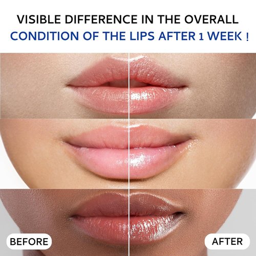 Skiennix Lip Sleeping Mask - Collagen-Infused Overnight Lip Plumper with Hyaluronic Acid | 20g for Smooth, Hydrated Lips