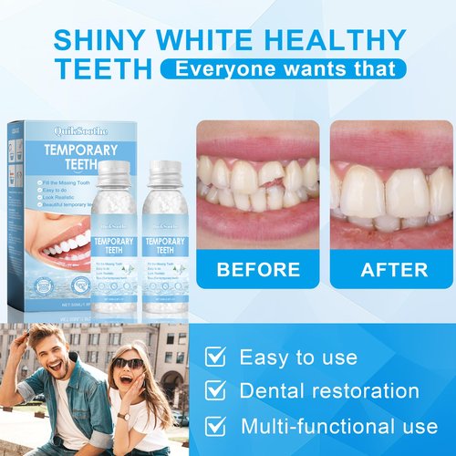Tooth Repair Kit – 2PCS Temporary Tooth Filling, Moldable False Teeth Beads for Teeth Repair, Make You Smile Confident Again