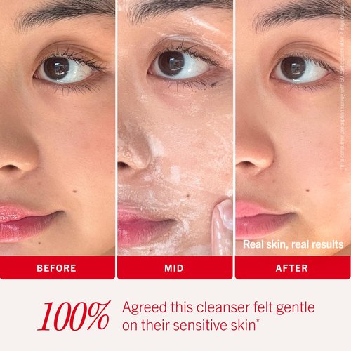 First Aid Beauty Ultra Gentle Cream-to-Foam Facial Cleanser – Makeup Removing Face Cleanser - Face Wash with Colloidal Oatmeal & Glycerin, for Sensitive, Acne & Blemish-Prone Skin, 6 oz