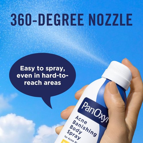 PanOxyl Acne Banishing Body Spray - 2% Salicylic Acid Treatment for Stubborn Breakouts | 6 Oz