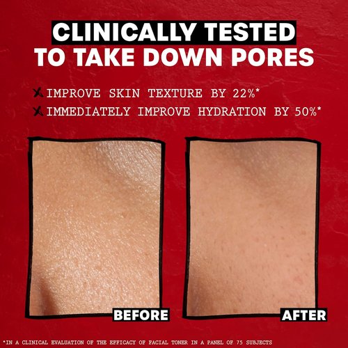 THAYERS Rose Petal Witch Hazel Facial Toner - Alcohol-Free, Soothing & Hydrating for All Skin Types, 12oz