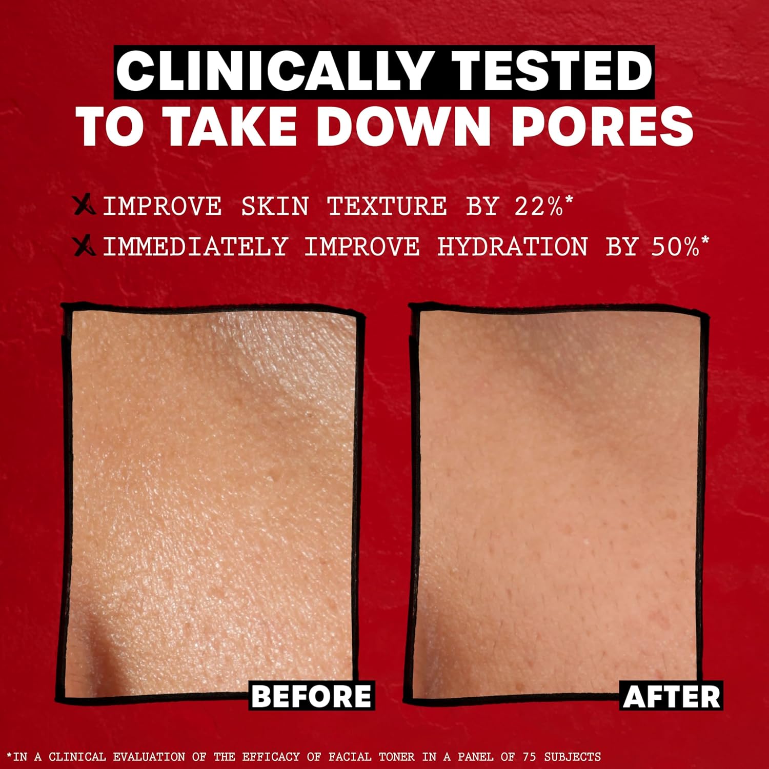 Thayers Alcohol-Free Rose Petal Witch Hazel Facial Toner - Soothing & Hydrating for Glowing Skin | 3oz