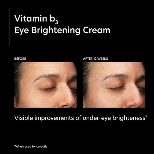 PCA SKIN Vitamin B3 Eye Brightening Cream - Anti-Aging Formula for Dark Circles & Wrinkles | 1 oz Tube