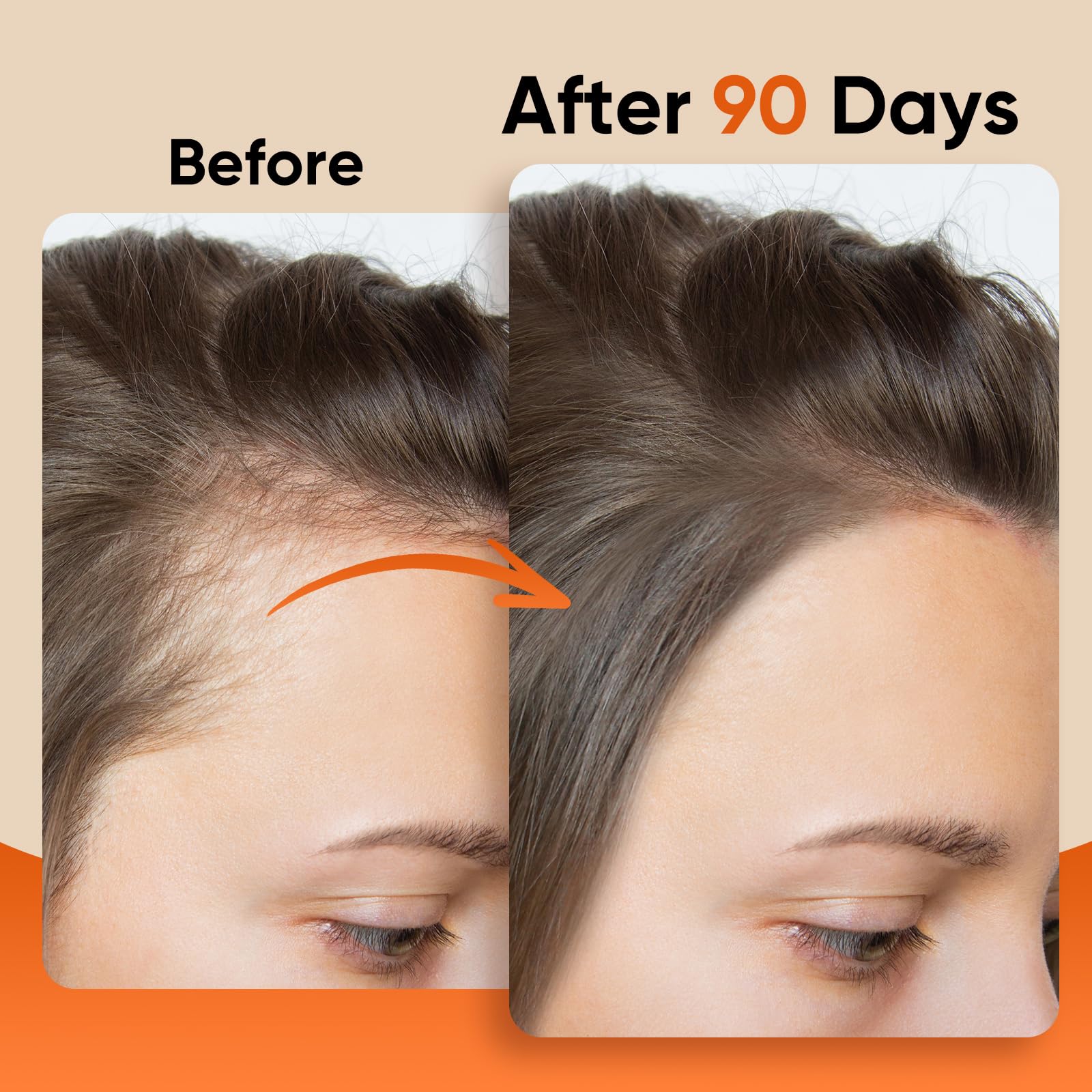 ZENTRIXA Batana Oil for Hair - 100% Raw, Cold Pressed, Unrefined & Organic Hair Mask - Prevents Hair Loss, Enhances Hair Thickness - For Men & Women, Essence for All Hair Types (16 oz)