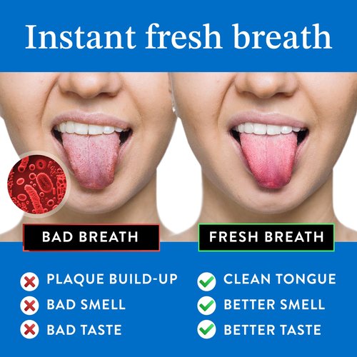 Mouthology Tongue Scraper (2 Pack), Reduce Bad Breath (Travel Cases Included), Stainless Steel Tongue Cleaners, Metal Tongue Scraper, Tongue Scraper for Adults - Fresher Breath in Seconds