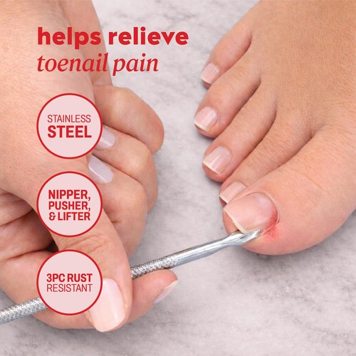 Onyx Professional Ingrown Toenail Kit with Toenail Clippers & Double-Ended Cuticle Pusher, Durable Stainless Steel, Easy to Use Ingrown Toenail Removal Kit, 2 Piece At-Home Pedicure Tools