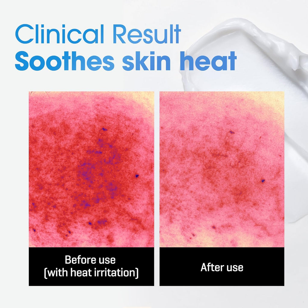 Some By Mi AHA BHA PHA Acne Clear Body Cleanser - Beta-Panthenol Repair Cream Bundle | 30 Days Supply