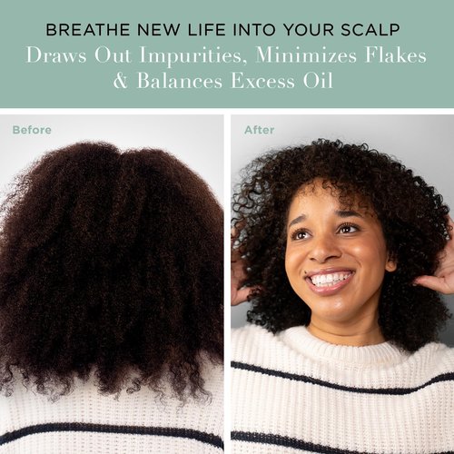 Unwash Charcoal Detox Scalp Scrub - Detoxify & Exfoliate Dry, Itchy Scalps | Paraben-Free, 8.82 oz