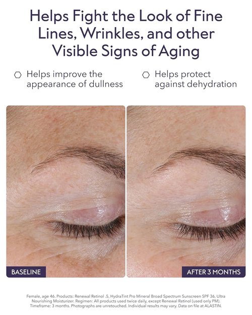 ALASTIN Skincare Renewal Retinol Serum - Improve Skin Texture & Tone | Reduce Fine Lines & Wrinkles