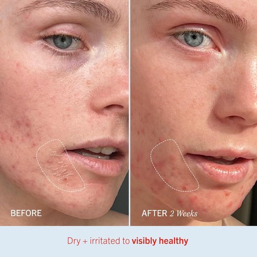 First Aid Beauty - Ultra Repair Cream | Intense Hydration with Whipped Oatmeal, 2 oz - Clinically Proven to Strengthen Skin Barrier & Relieve Eczema
