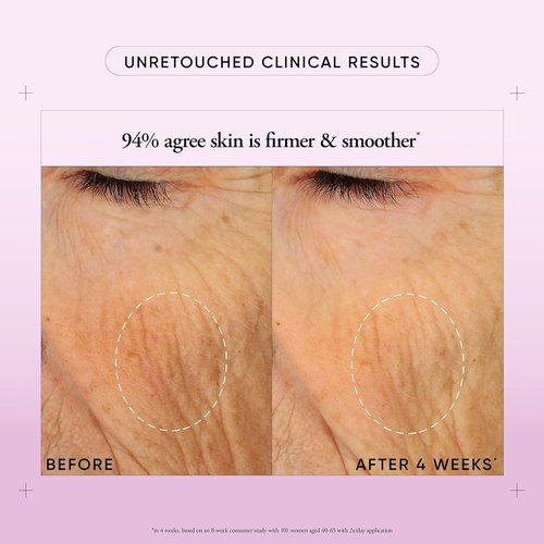 Philosophy Ultimate Miracle Worker Face & Neck Cream - Nourishing Retinol & Ceramides - Smooths Fine Lines & Wrinkles